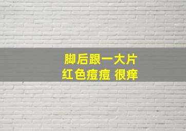 脚后跟一大片红色痘痘 很痒